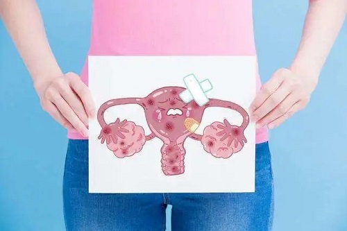 婦科疾病有哪些癥狀 本文盤點(diǎn)女性婦科疾病的癥狀