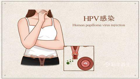 hpv自查的10個方法是什么 女性hpv最初的征兆有哪些