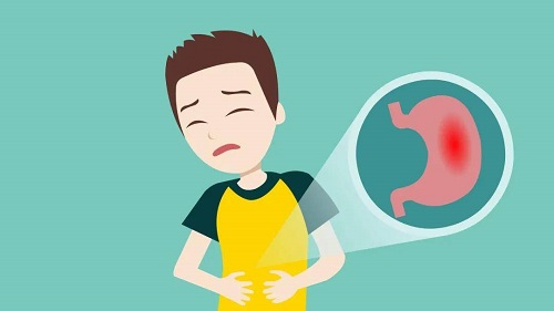 哪三個(gè)征兆說(shuō)明已有胃癌 有胃癌是什么感覺(jué)