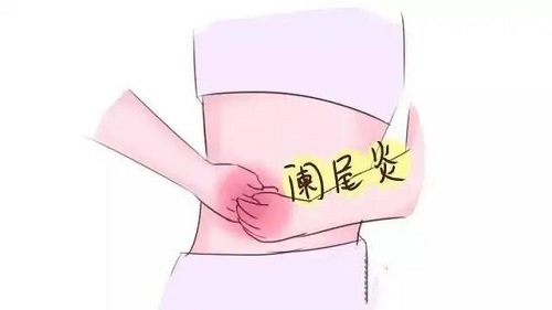 闌尾炎是哪個(gè)部位疼 闌尾炎一定要開(kāi)刀嗎