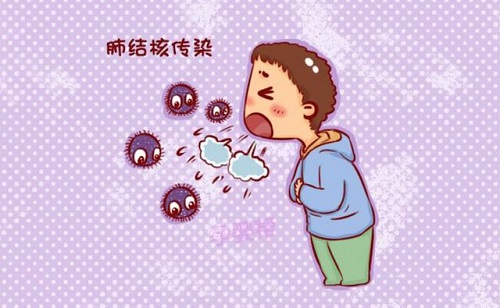 肺結核會傳染嗎 肺結核早期的5個信號是什么
