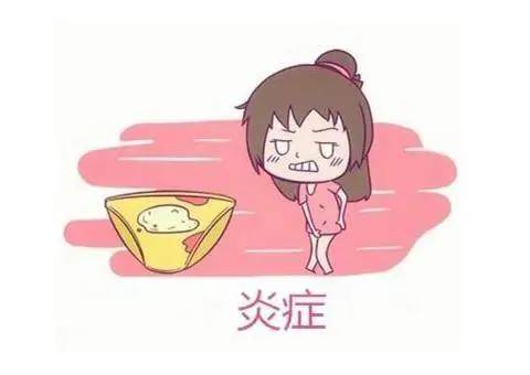 婦科炎癥用什么藥消炎最好 婦科炎癥六大表現(xiàn)是什么