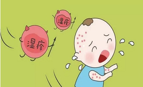 皮膚過(guò)敏是什么癥狀 皮膚過(guò)敏了多久才能恢復(fù)